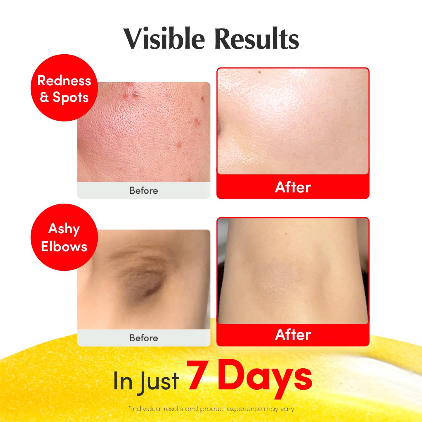 Vitamin Illuminating Serum – Niacinamide 4% + Vitamin C Brightening Care