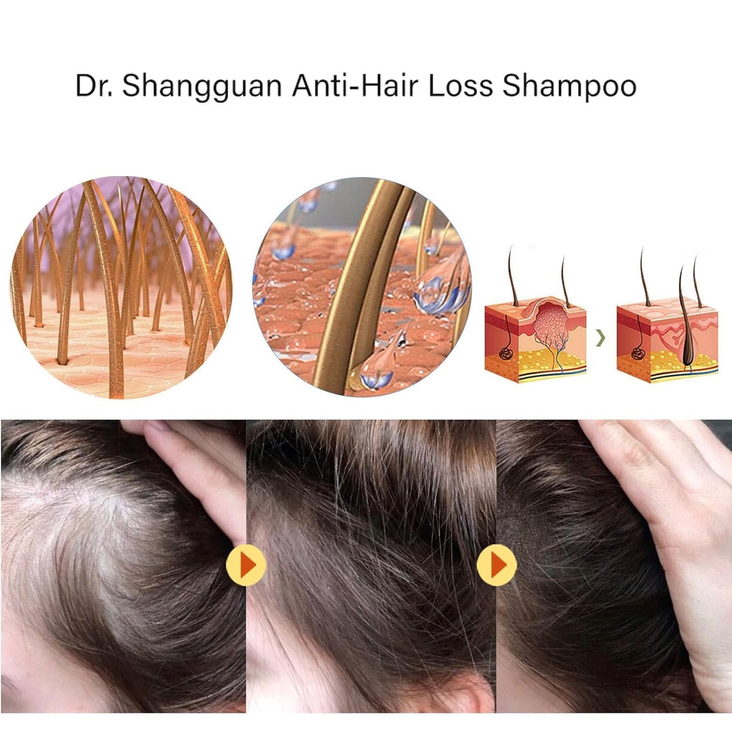 Anti-Hair Loss &amp; Hair Growth Shampoo