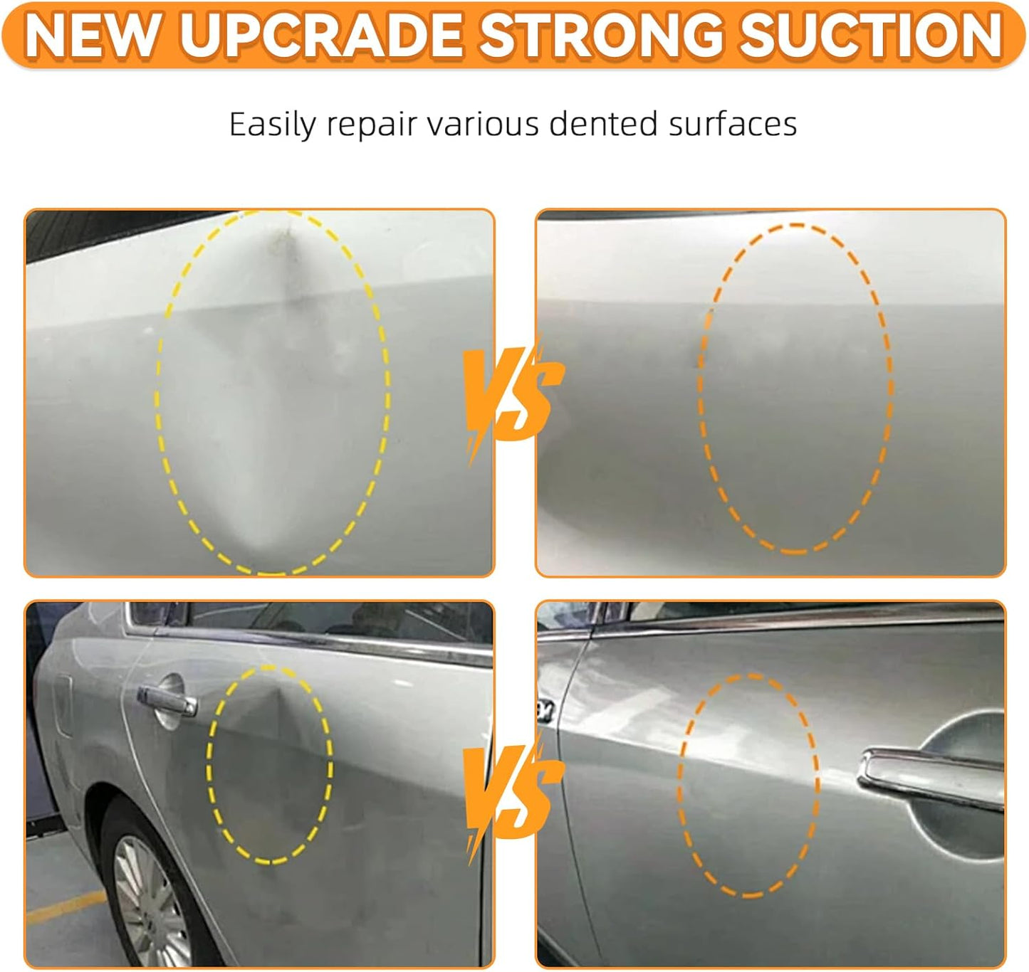 Car Dent Remover Puller Cups – Easy DIY Dent Repair Tool