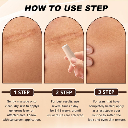 Acne Scar Repair Stick – Targeted Spot Treatment for Smooth Skin