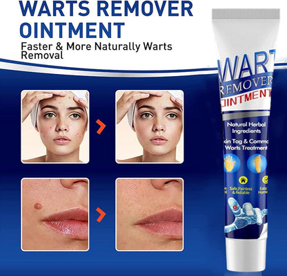 Wart Instant Blemish Cream