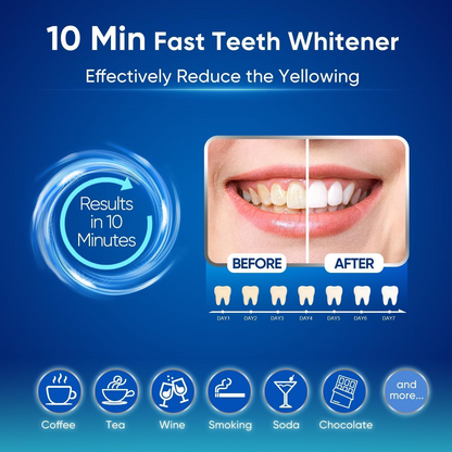 LED Teeth Whitening Kit – Blue Light Home & Dental Use