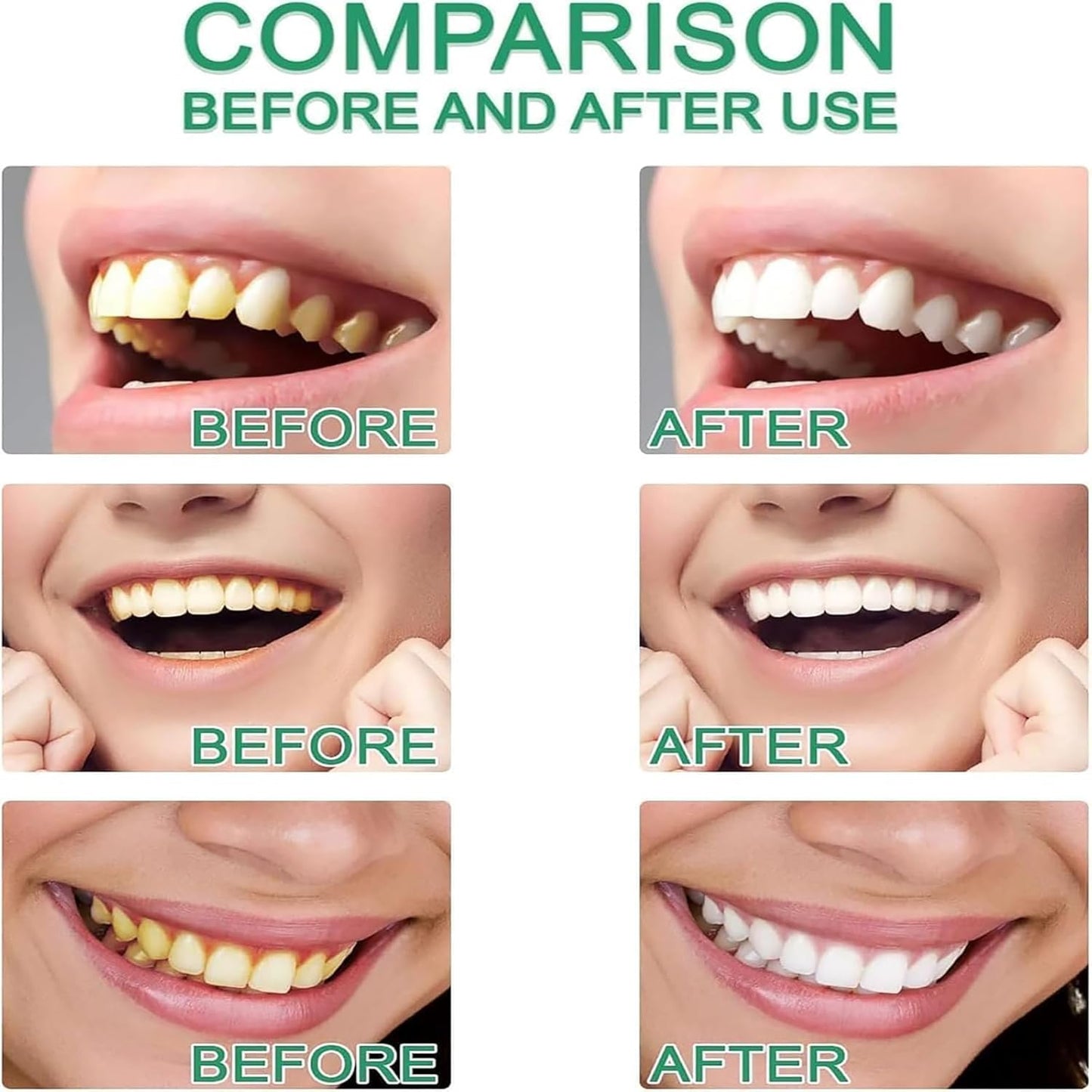 Niacinamide Toothpaste – Whiten, Strengthen & Refresh Naturally