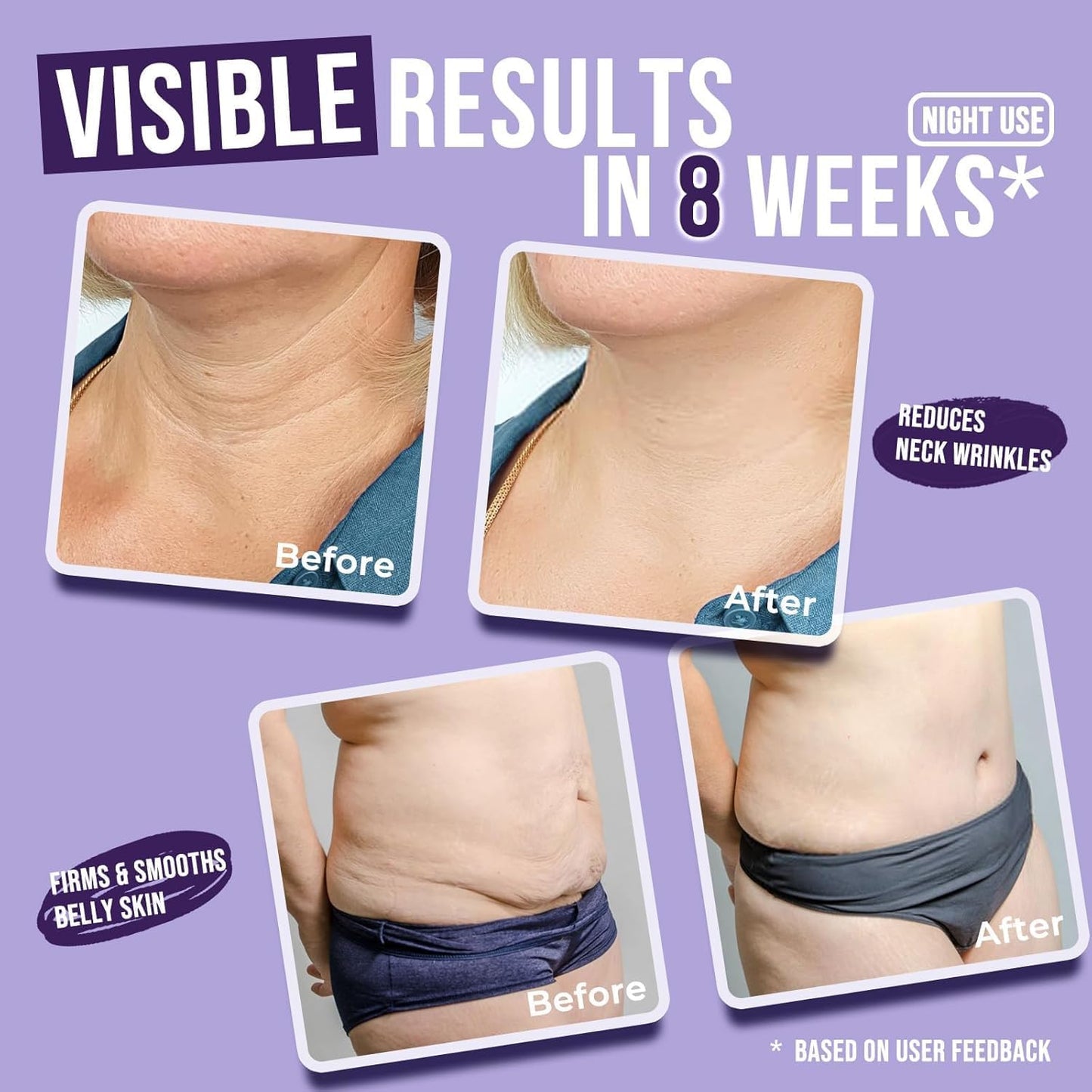 Glow While You Rest – Firm, Lift, and Tone Overnight
