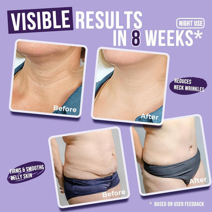 Glow While You Rest – Firm, Lift, and Tone Overnight