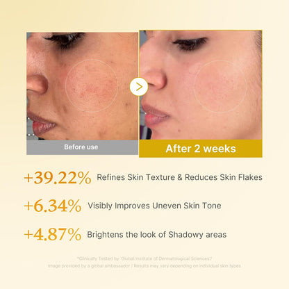 KOEC Kojic Acid & Turmeric Toner – Brighten & Refresh Your Skin!