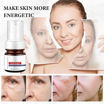 Dark Spot Corrector Serum – Advanced Brightening for Face & Body
