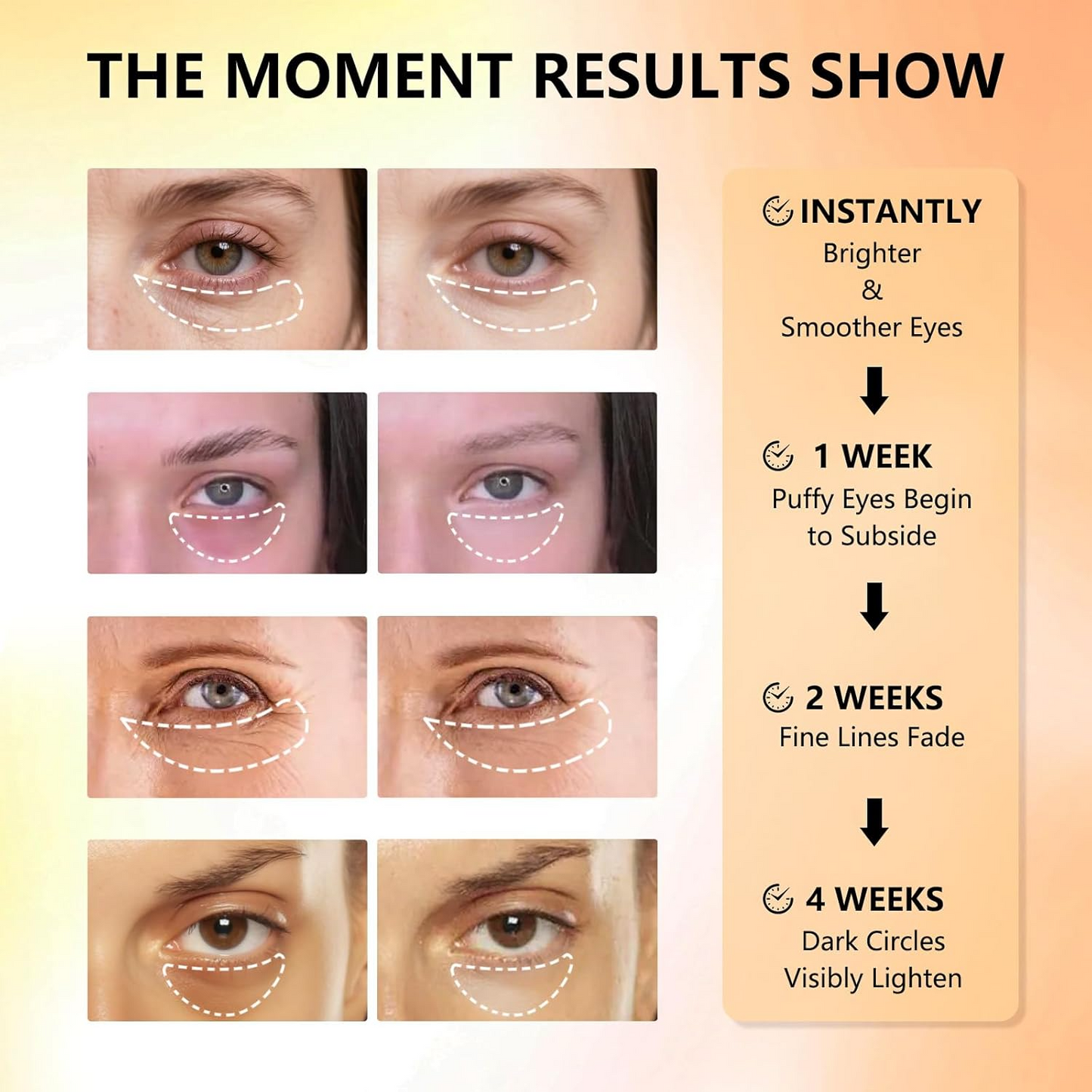 Hydrogel Collagen Eye Patches – Deep Hydration & Brightening Care