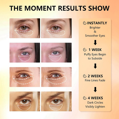 Hydrogel Collagen Eye Patches – Deep Hydration & Brightening Care