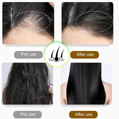 Anti-Hair Loss & Hair Growth Shampoo
