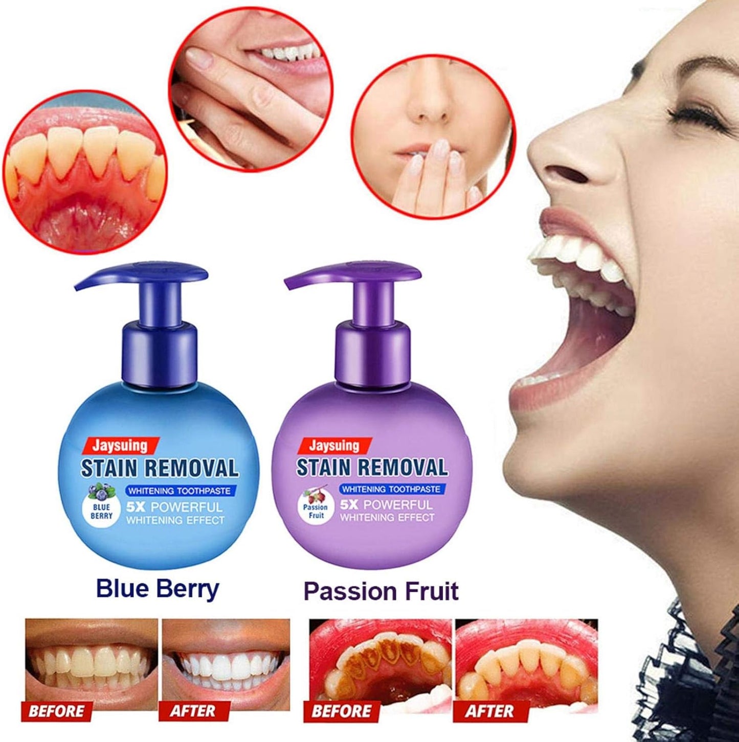 Intensive Stain Removal Whitening Toothpaste