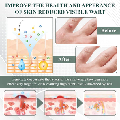 Luhaka® NATURESTORE Instant Mole & Spot Gel