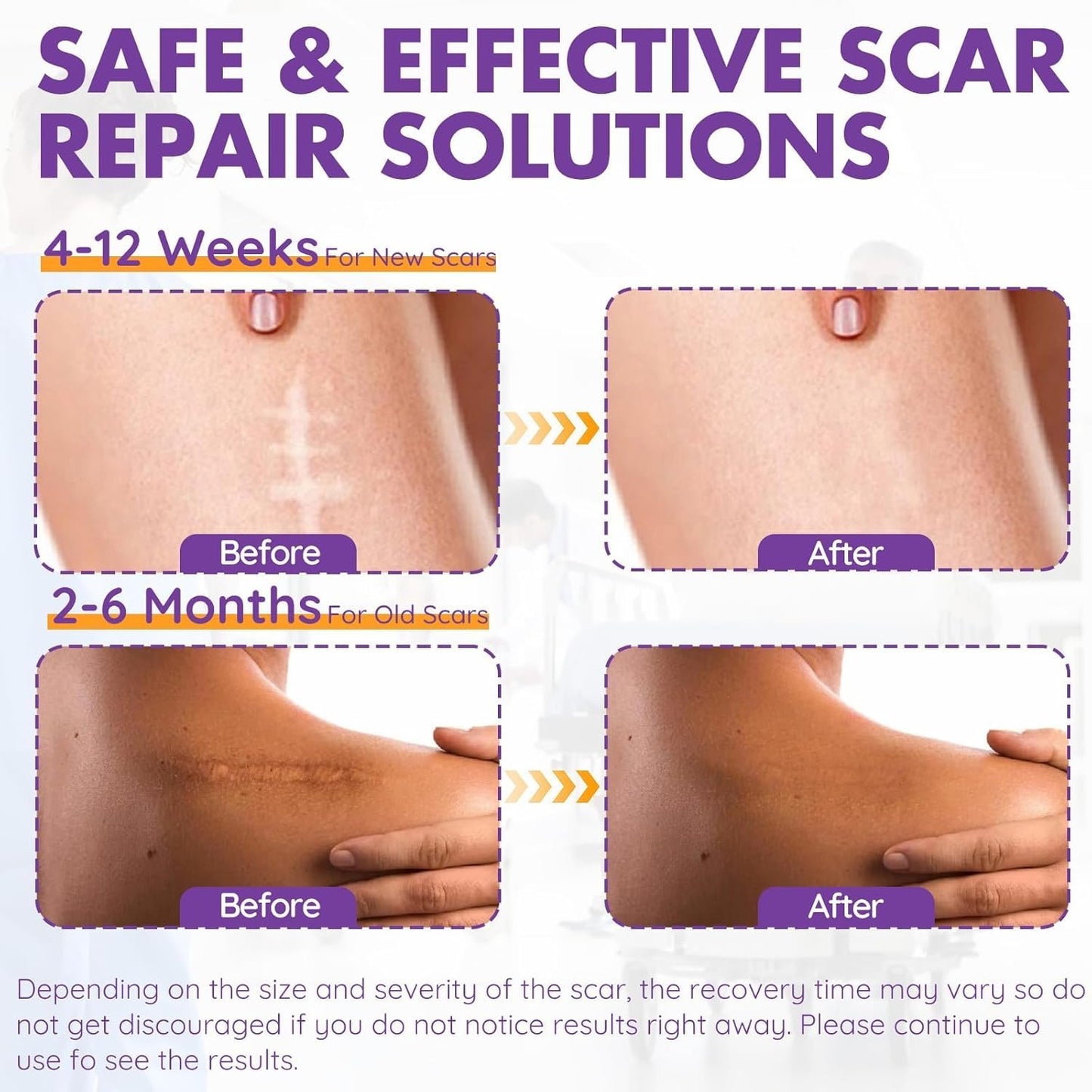 Scar Removal Patches – Smooth, Fade & Heal with Confidence
