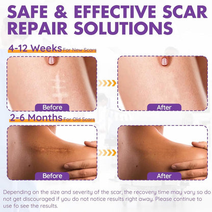 Scar Removal Patches – Smooth, Fade & Heal with Confidence