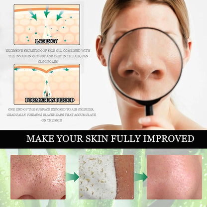 Green Tea Nose Mask – Peel-Off Blackhead Remover &amp; Pore Tightener