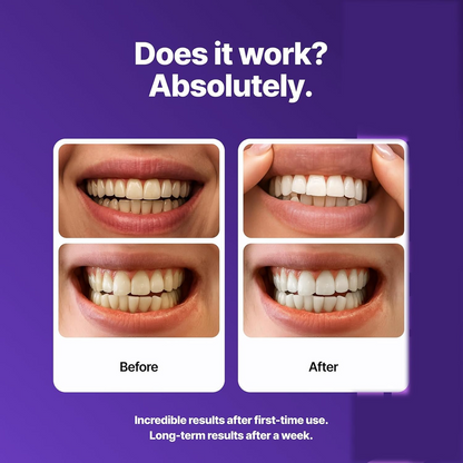 Purple Teeth Whitening Strips – Instant Brightening & Color-Correcting Care