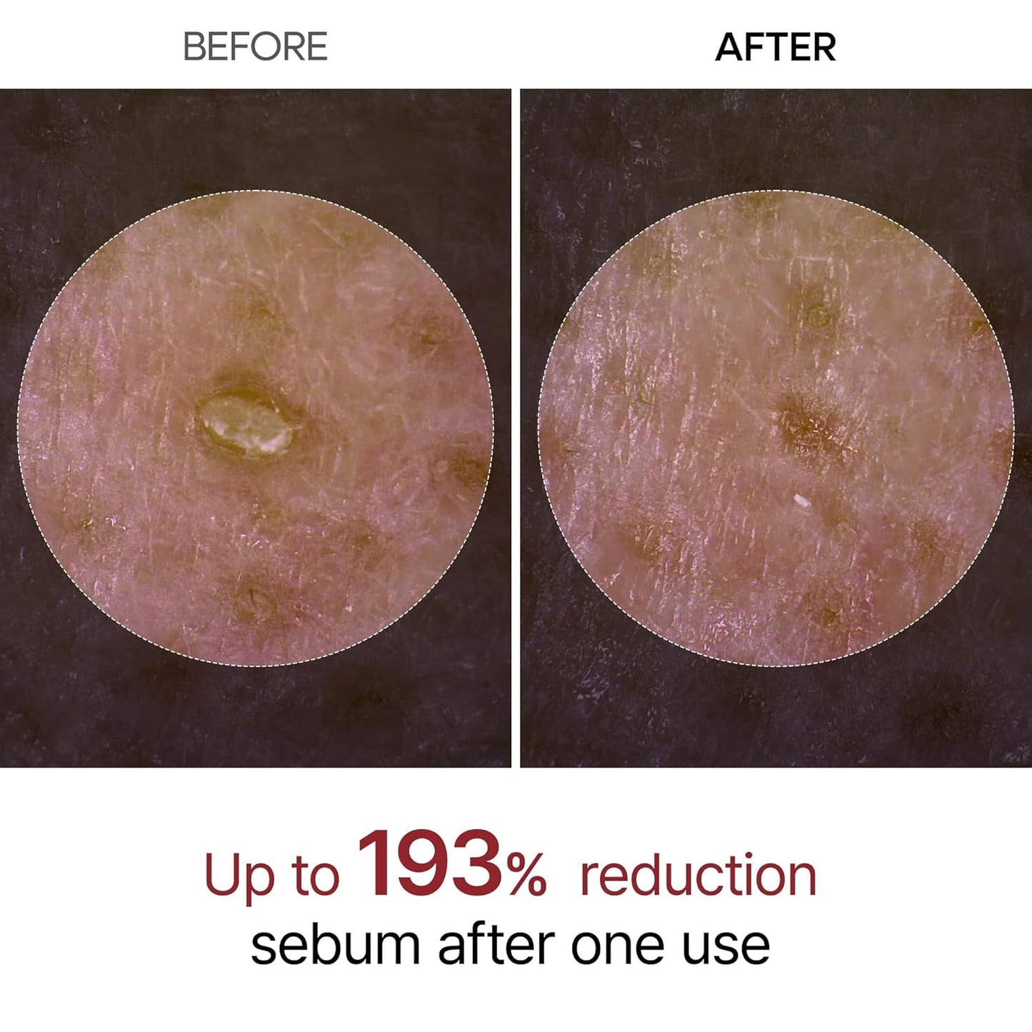 Peel Shot — Kojic + Turmeric Body Peel Spray