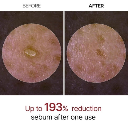 Peel Shot — Kojic + Turmeric Body Peel Spray