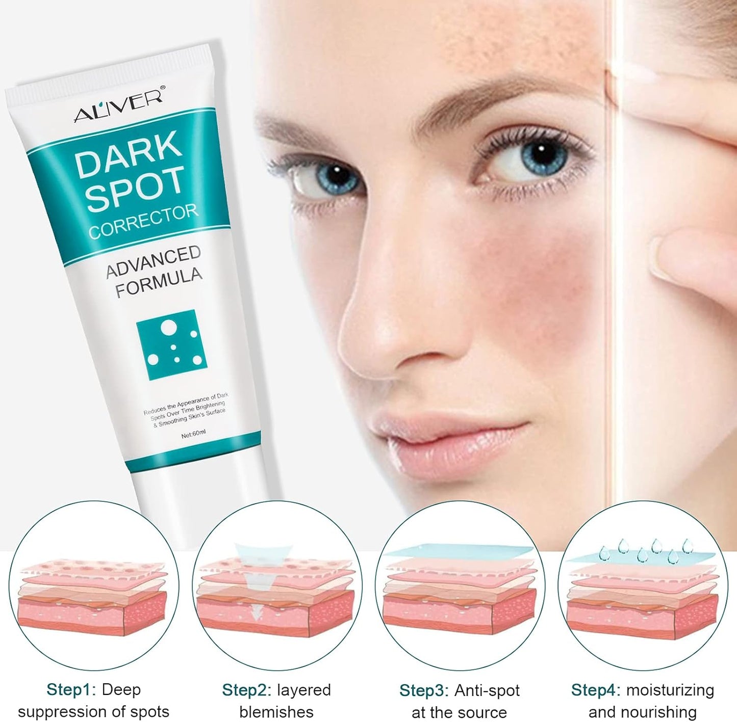 Spot Cream Melasma Remover – 30g Dark Spot & Freckle Corrector