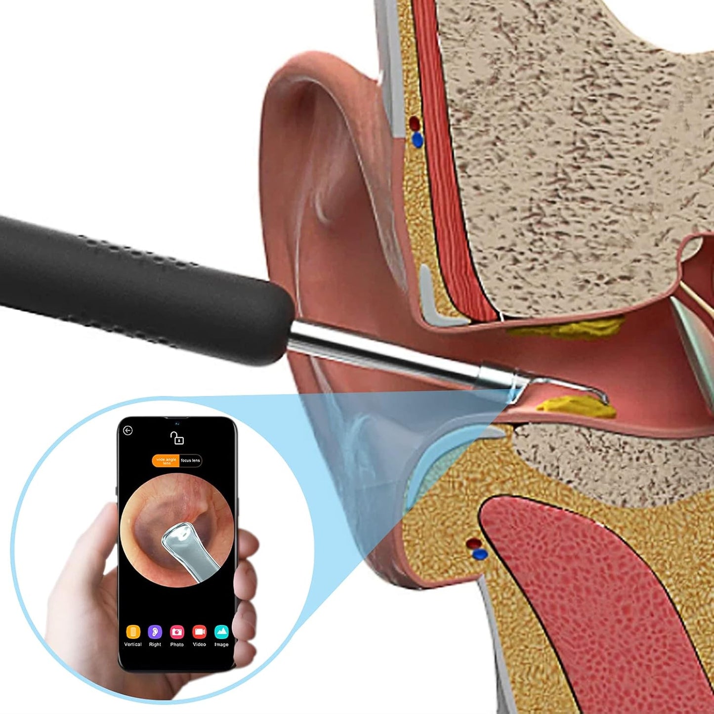 Visual Electric Ear Wax Removal Tool