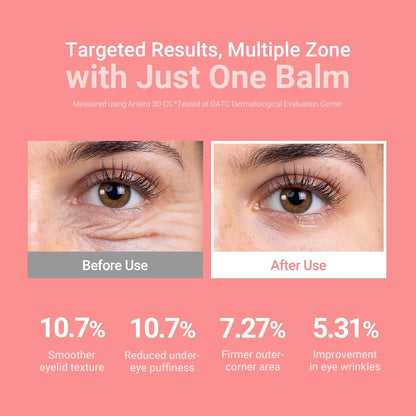 Korean Eye Balm Stick – Hydrating Under Eye Brightener for a Fresh Glow