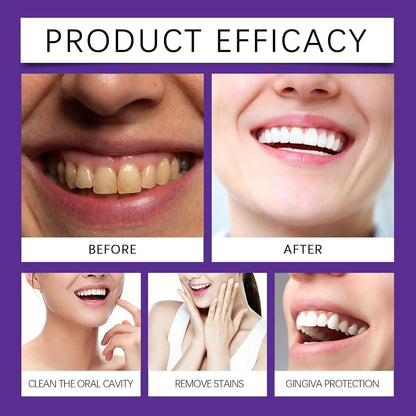 Purple Teeth Whitening Powder – Deep Cleansing & Stain Removal