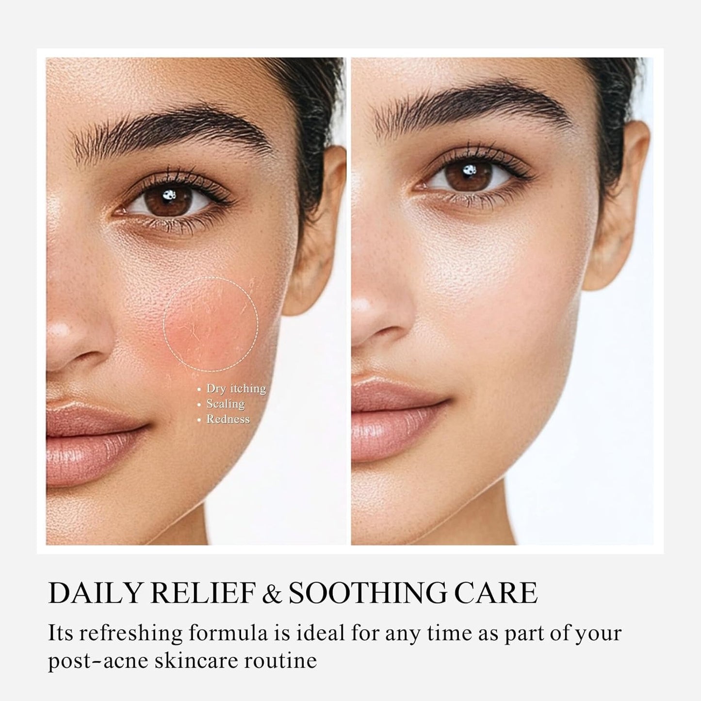 Soft Repair Moisturizing Face Cream – Mild Hydrating & Brightening Care