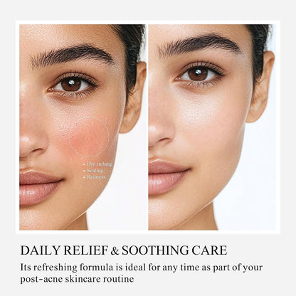 Soft Repair Moisturizing Face Cream – Mild Hydrating & Brightening Care