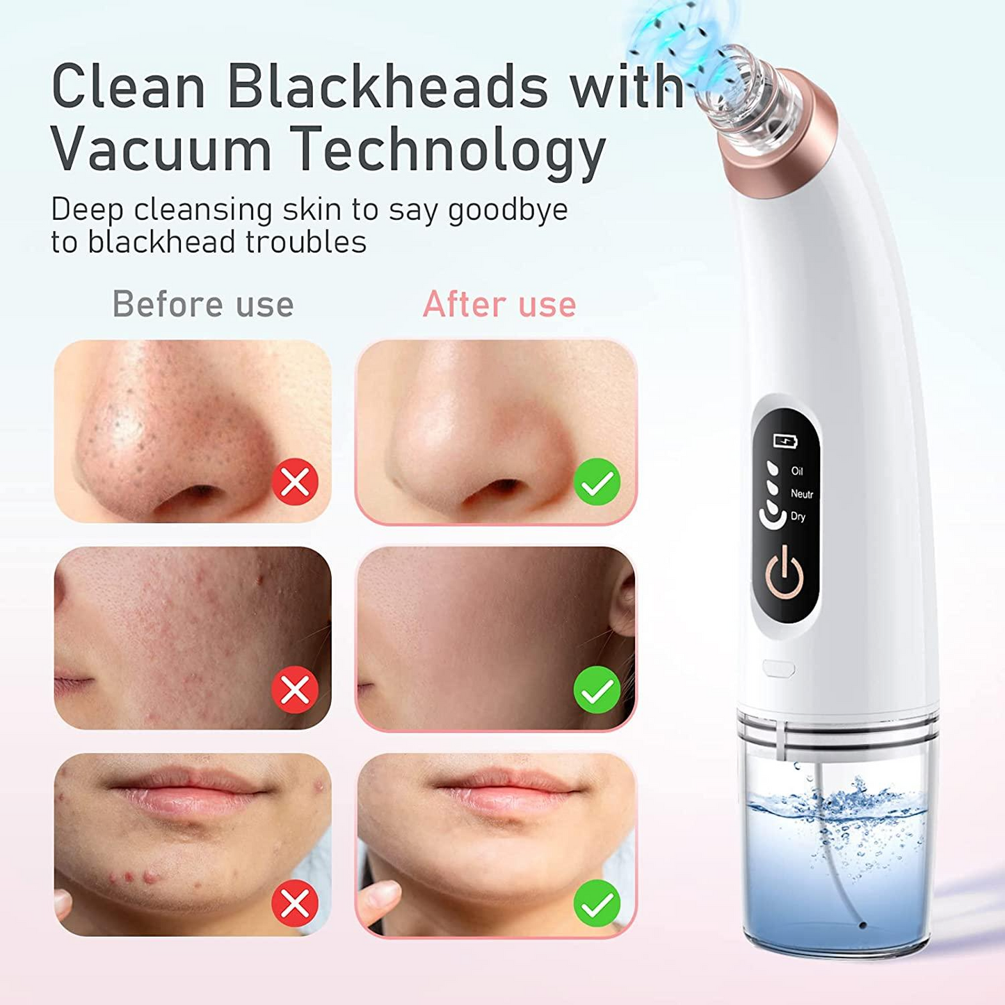 Portable LED Rechargeable Blackhead Remover