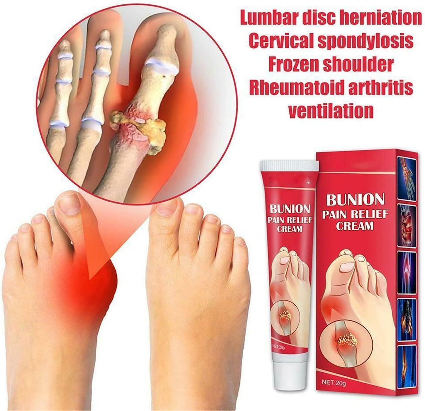 Bunion Pain Relief Cream – Soothing Herbal Comfort for Achy Feet