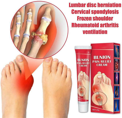 Bunion Pain Relief Cream – Soothing Herbal Comfort for Achy Feet