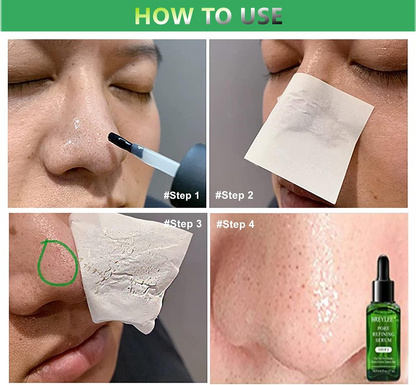 Blackhead Remover Serum Pore Cleansing Skincare