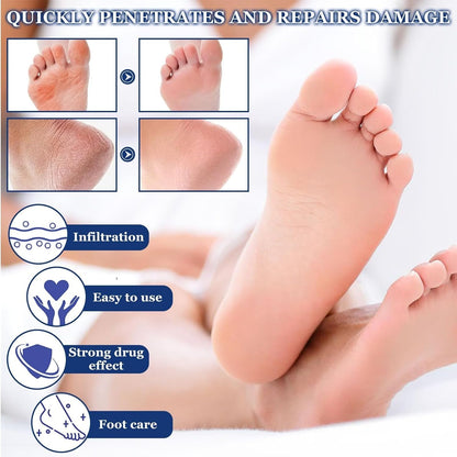 Exfoliating Urea Foot Cream – Deep Repair & Softening Foot Care