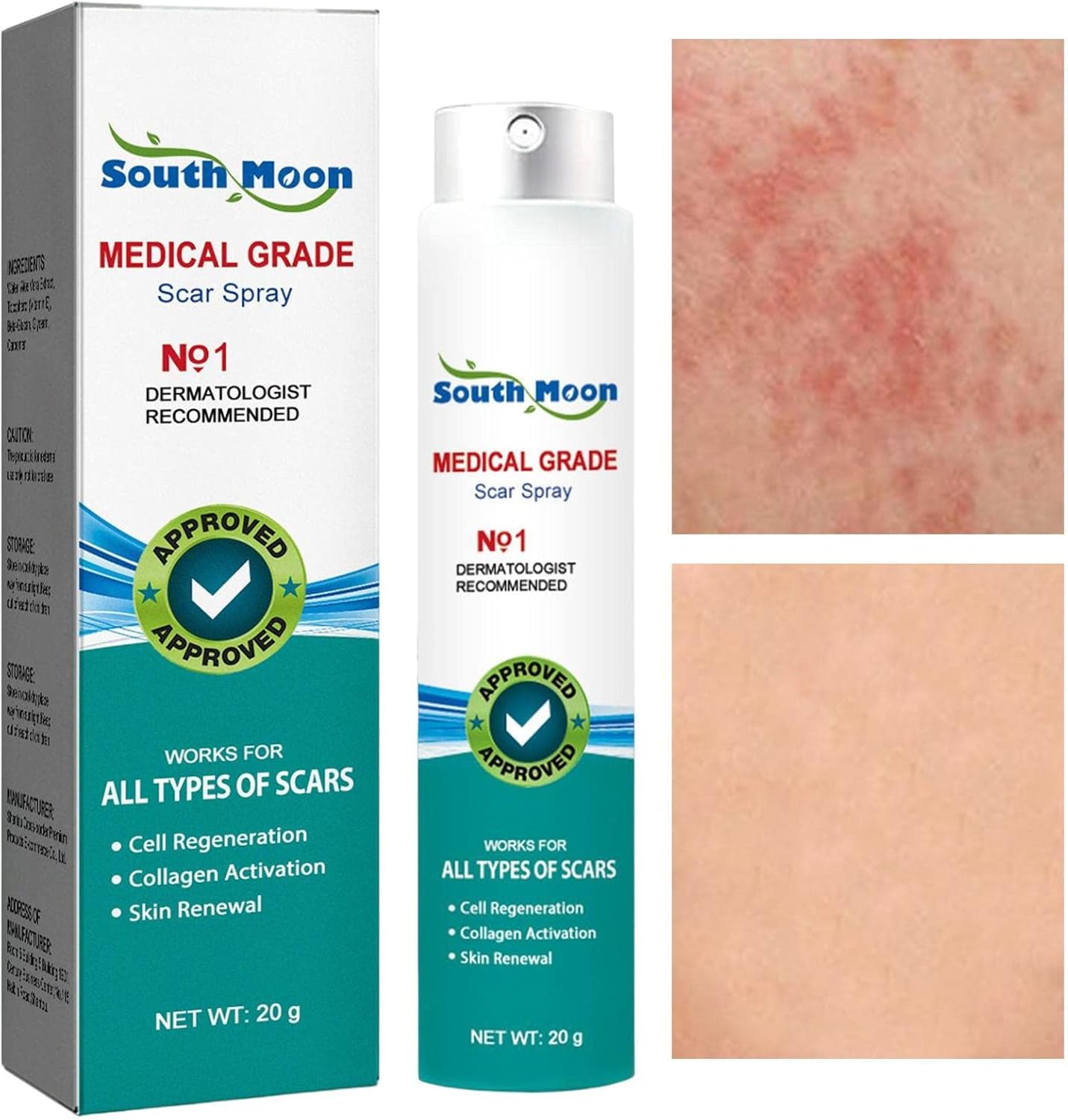 Advanced Scar Removal Spray