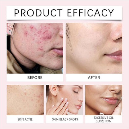Exfoliating Turmeric Kojic Acid Pads