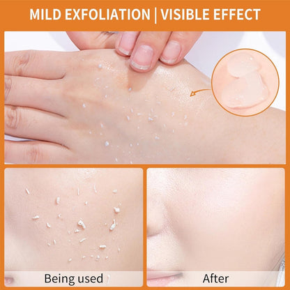 Orange Enzyme Exfoliating Gel – Glow Naturally, Peel Gently