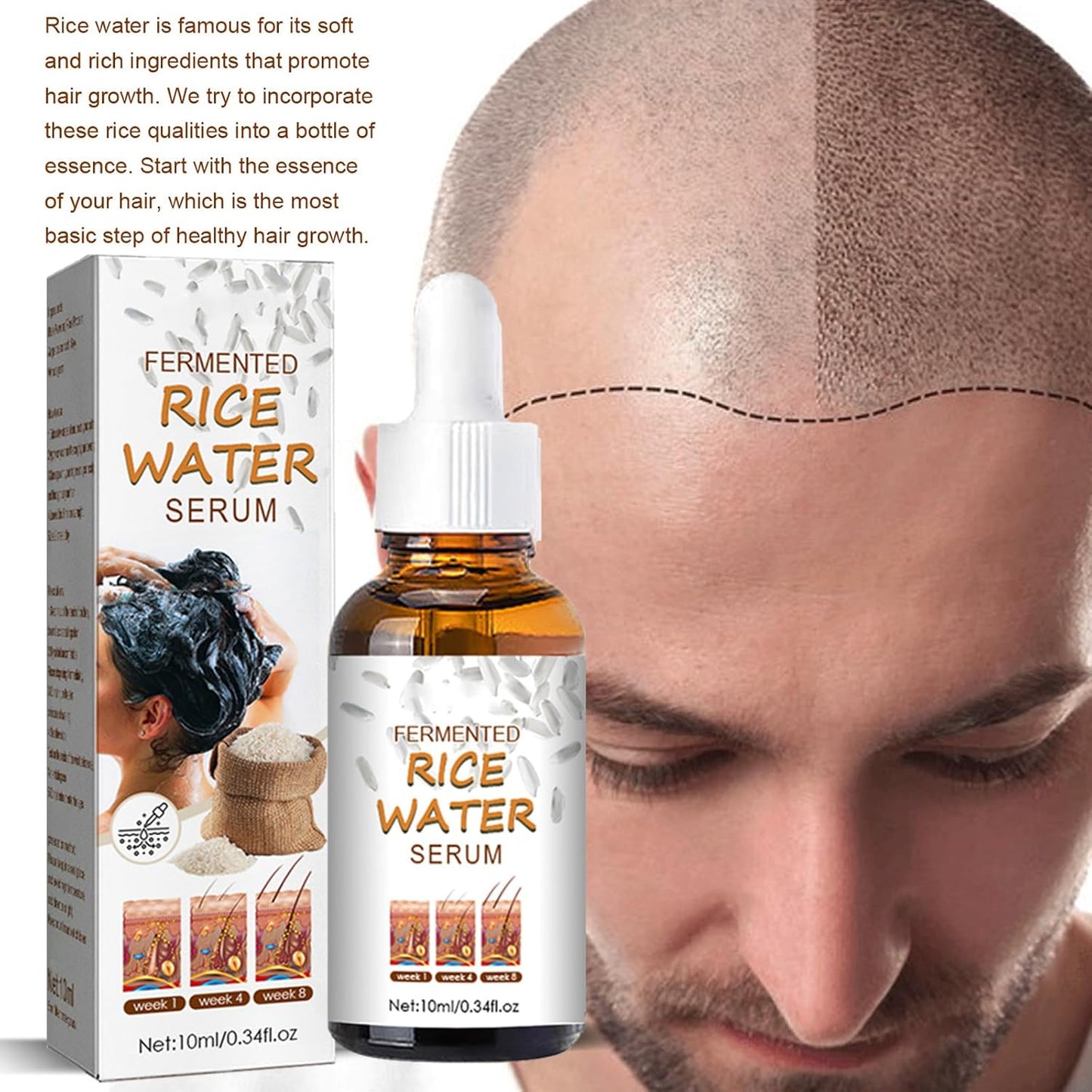 Ceoerty™ HGrow Rice Water Hair Essence