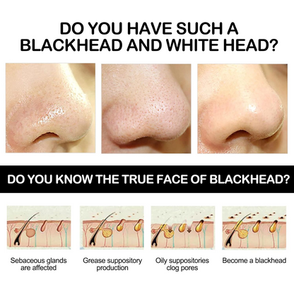 Peel Off Blackhead Remover Mask – Deep Clean & Smooth Pore Care