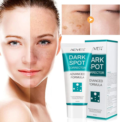 Spot Cream Melasma Remover – 30g Dark Spot & Freckle Corrector