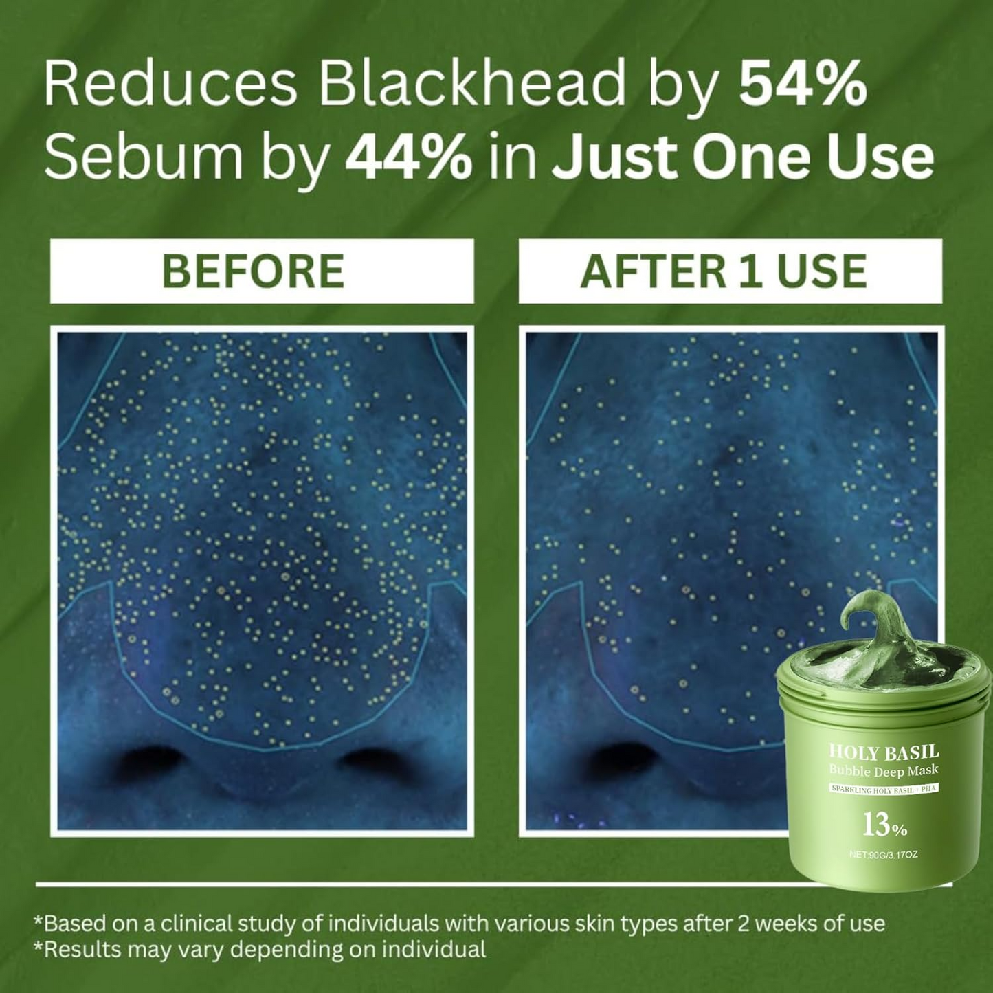 Deep Cleansing Face Mask – Blackhead Removal & Oil Control Care