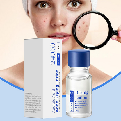 Salicylic Acid Spot Drying Lotion – Targeted Acne Care