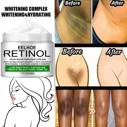 Body Whitening & Brightening Cream – Targeted Care for Underarm, Knees & Intimate Areas