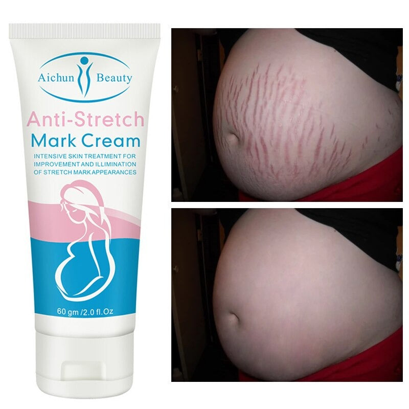 Aichun Beauty Natural Pregnancy Stretch Mark Cream