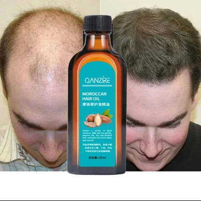 Fivfivgo™ Moroccan Hair Oil