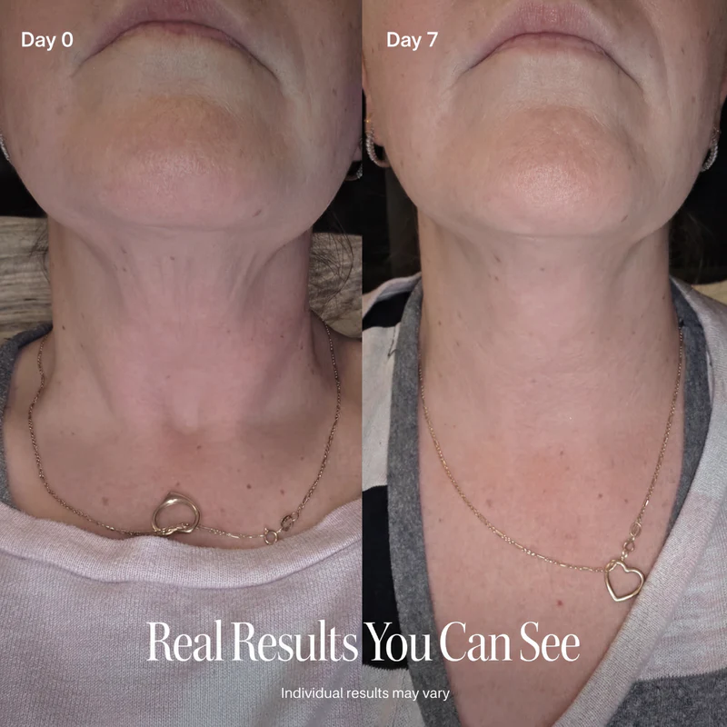 Neck Firming Roller Cream – Lift, Smooth & Tighten Skin