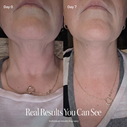 Neck Firming Roller Cream – Lift, Smooth & Tighten Skin