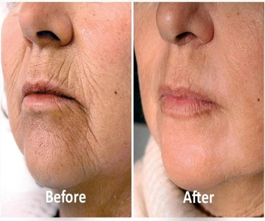 Ginseng Polypeptide Anti-Ageing Essence