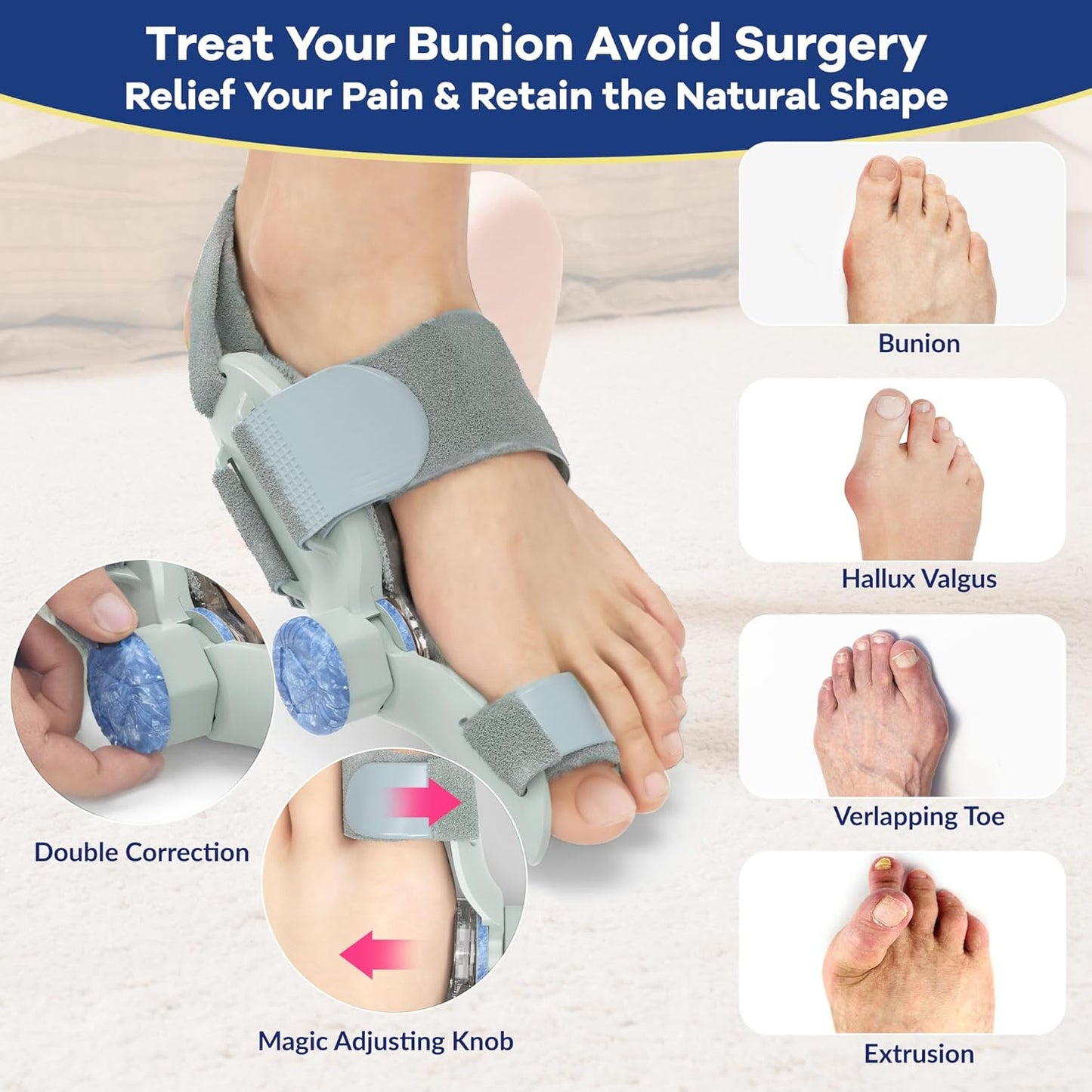 Bunion Fix Toe Valgus Corrector – Adjustable Orthosis Splint for Pain Relief & Alignment