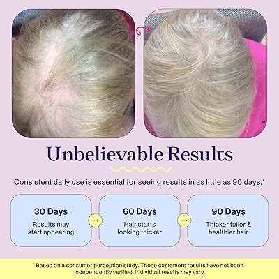 Multi Collagen Peptides Powder – Daily Collagen Support Supplement