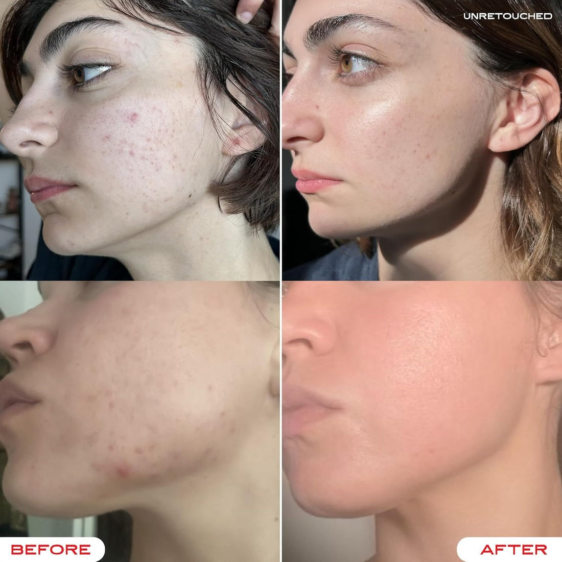 Face Cream – Deep Hydration & Anti-Aging Moisturizer